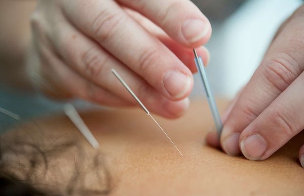 Quels sont les bienfaits de l'acupuncture pour la gestion des symptômes de la ménopause?